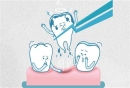 干槽症一般在拔牙后几天出现