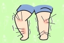 腿部肌肉疼痛缓解方法介绍