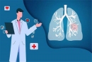 肺部结节是怎么形成的