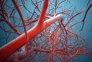 血管畸形是什么病严重吗